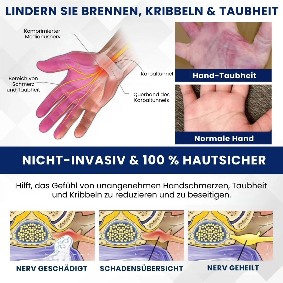 NervoVital™ | Nervenschmerz-Linderungscreme