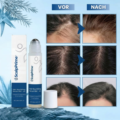ScalpPrime™  | Nährendes Haarserum Roll-On