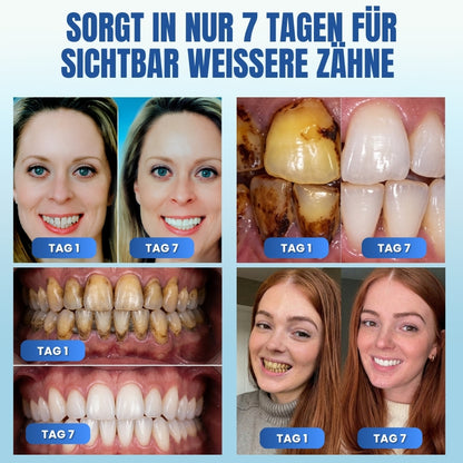 SensWhite™ | Ultra Whitening Mundspül-Tablette