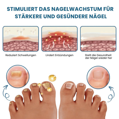 Nailixir™ | Nagelpilzbehandlungssalbe