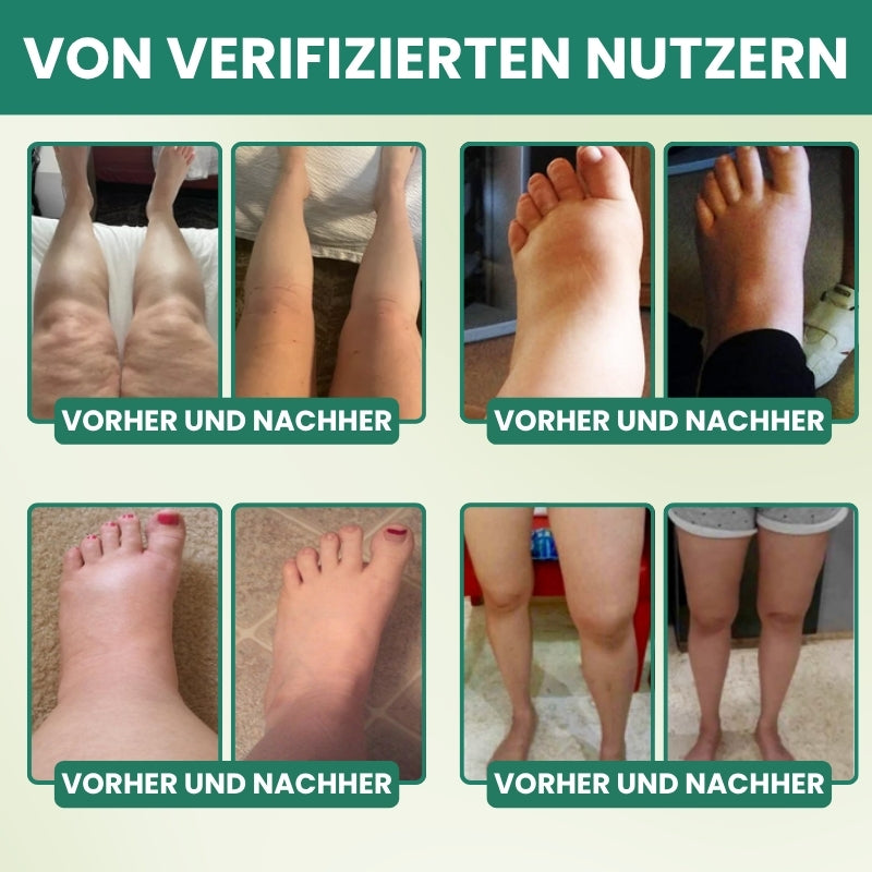 LymphoFlow™ | Lymphatische Drainage Kräuterkapseln