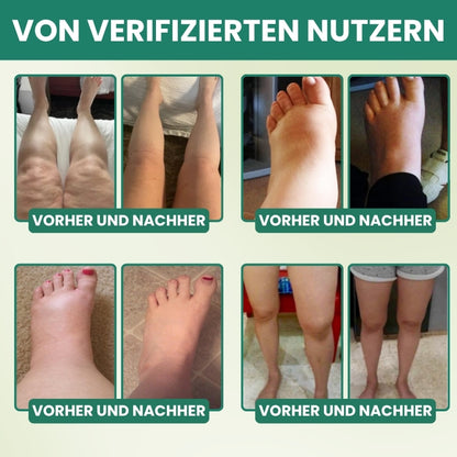 LymphoFlow™ | Lymphatische Drainage Kräuterkapseln