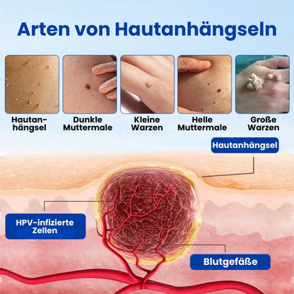 WartFix™ | Warzenentferner-Salbe
