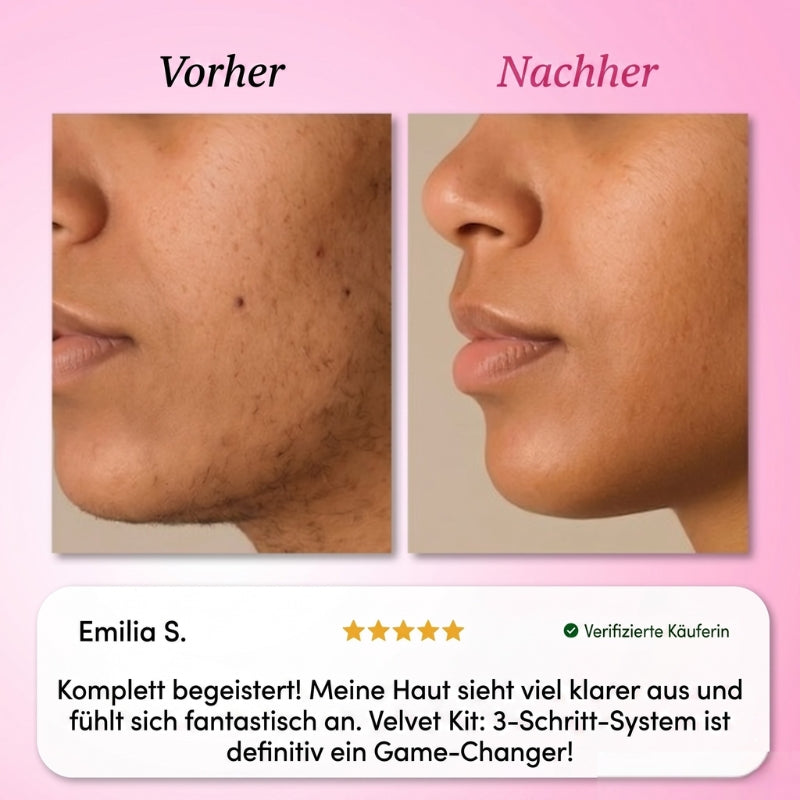 Velvet Kit: 3-Schritt-System
