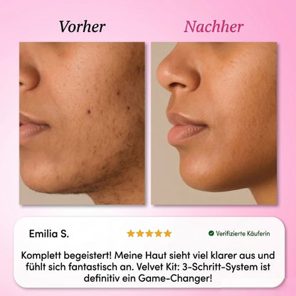 Velvet Kit: 3-Schritt-System