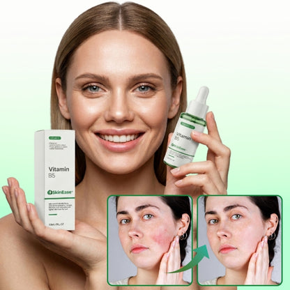 SkinEase™ | Beruhigendes Serum für reaktive, zu Rötungen neigende Haut