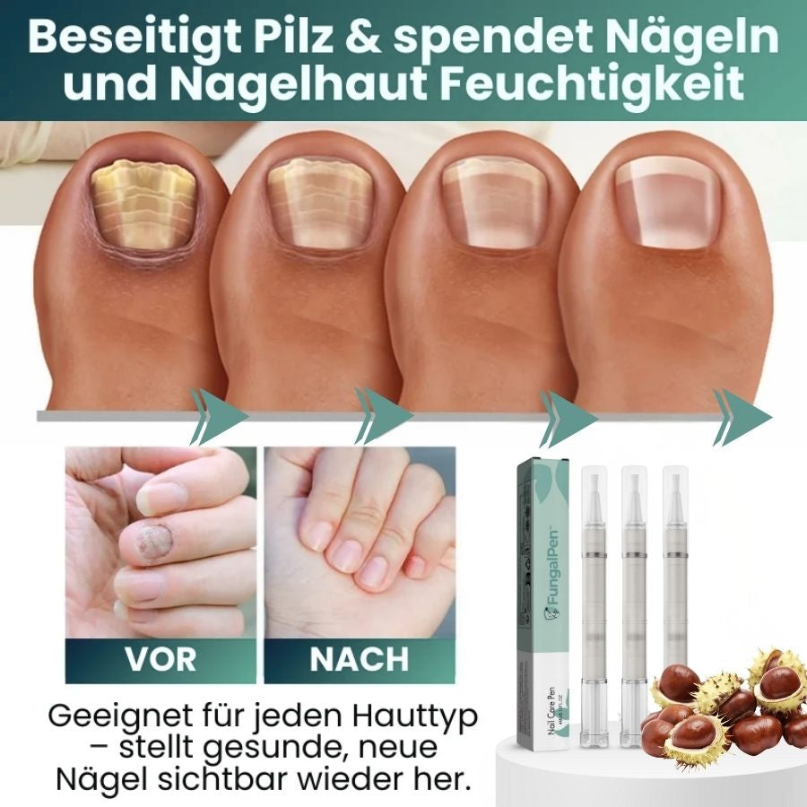FungalPen™ | Nagelpflege Anti-Pilz-Stift