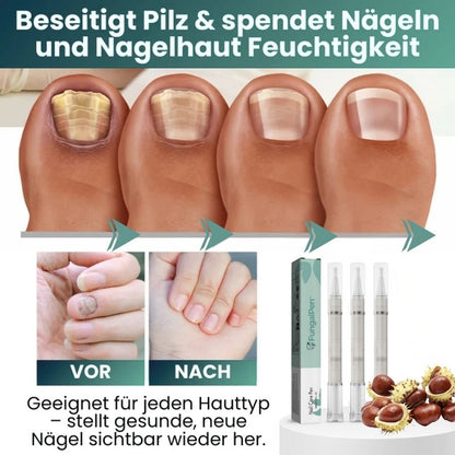 FungalPen™ | Nagelpflege Anti-Pilz-Stift