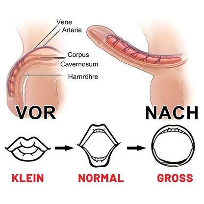 AlphaMann™ | Pflaster gegen Erektionsstörungen