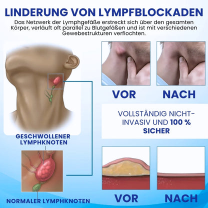 LymphoEase™ | Fühlen Sie sich in nur 14 Tagen leicht, entspannt und frei von Schwellungen