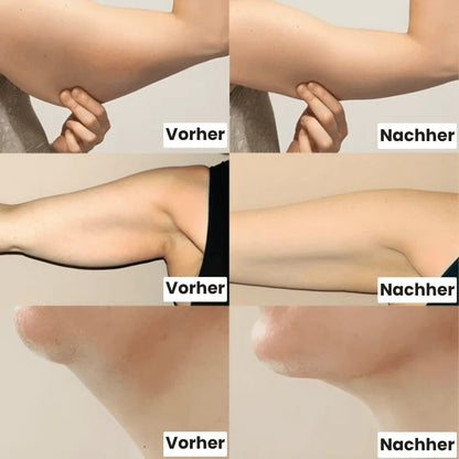 LymphoClear™ | Kräutertropfen gegen Blähungen und Schwellungen