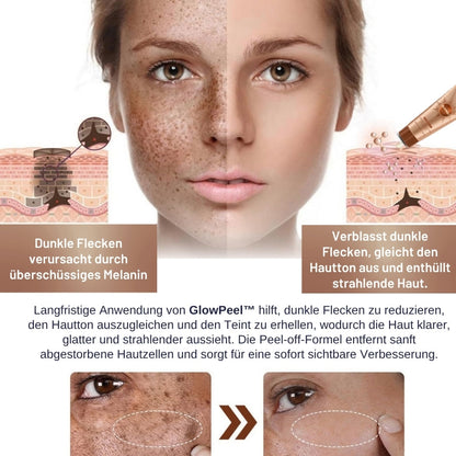 GlowPeel™ | Peeling-Gesichtsmaske