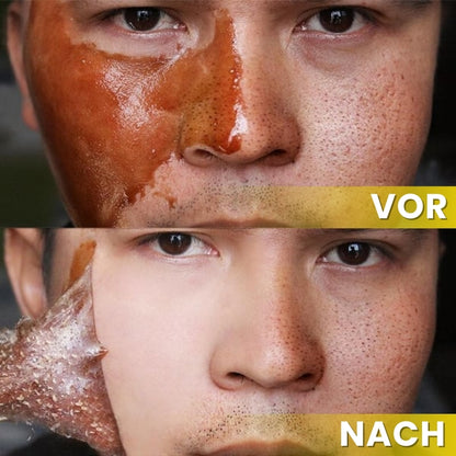HoneyGlow™ | Kräuter-Peel-Off-Gesichtsmaske mit Honig für Flecken