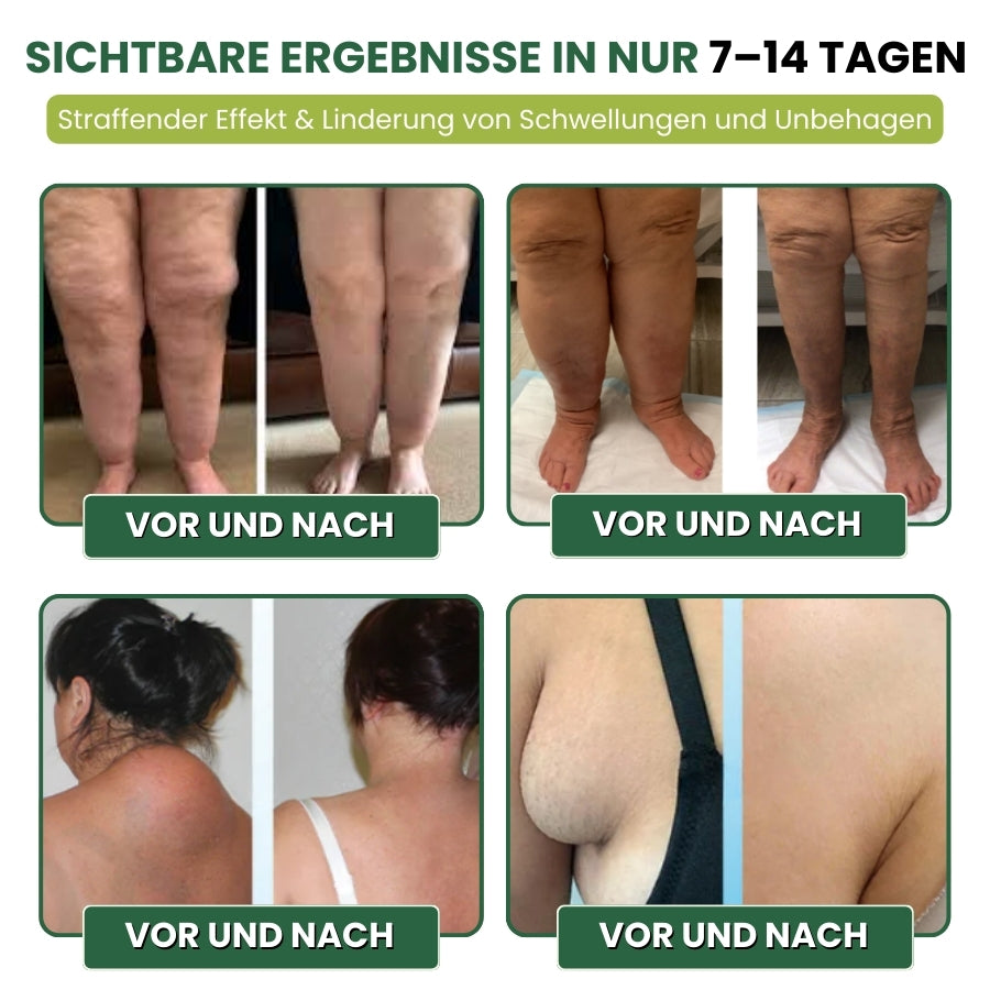 MiracleBalm™ | Beinschwellungen Linderndes Pflege-Balsam