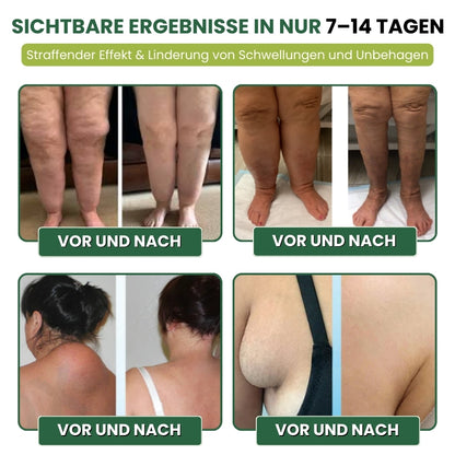 MiracleBalm™ | Beinschwellungen Linderndes Pflege-Balsam