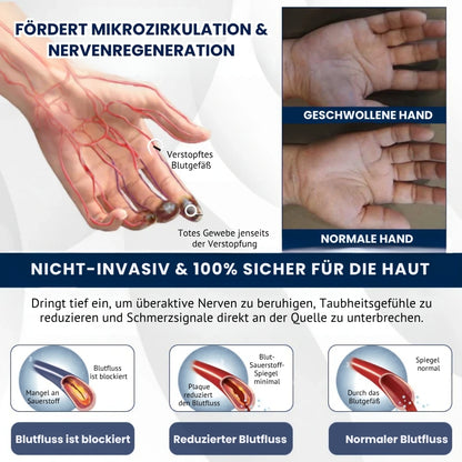 NerviFree™ | Roll-On gegen Nervenschmerzen