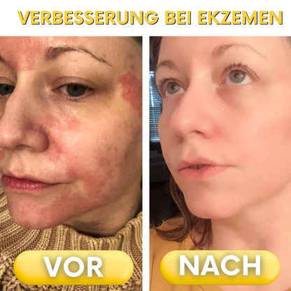 NaturDerm™ | Haut Beruhigende Kräutersalbe