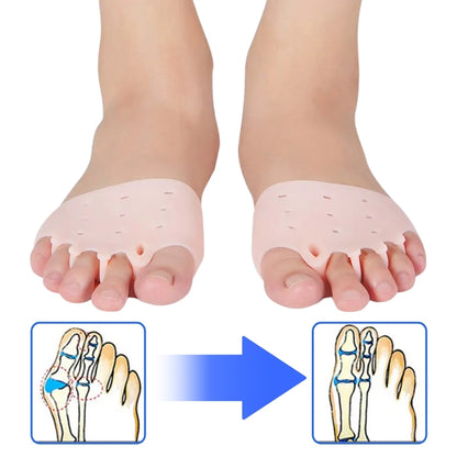 ToeAligner™ | Hallux Valgus Therapeutische Einlegesohlen