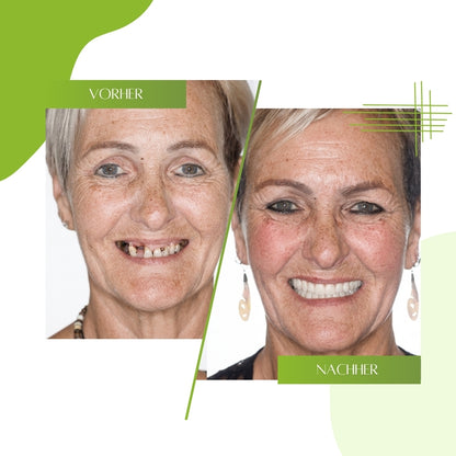 Dentix™ | Thermoplastisches Zahnprothesen-Gel