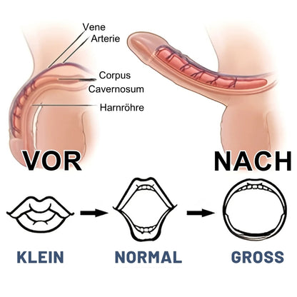 ErecKing™ | Männliches Verstärkungs-Erektions-Pflaster Pro