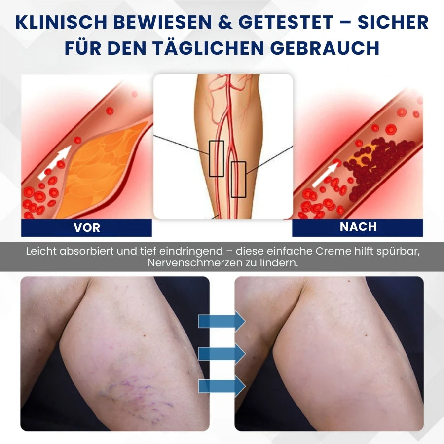 NervoVital™ | Nervenschmerz-Linderungscreme