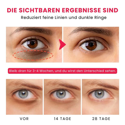 EyeLiss™ | Retinol Augen-Stick Creme