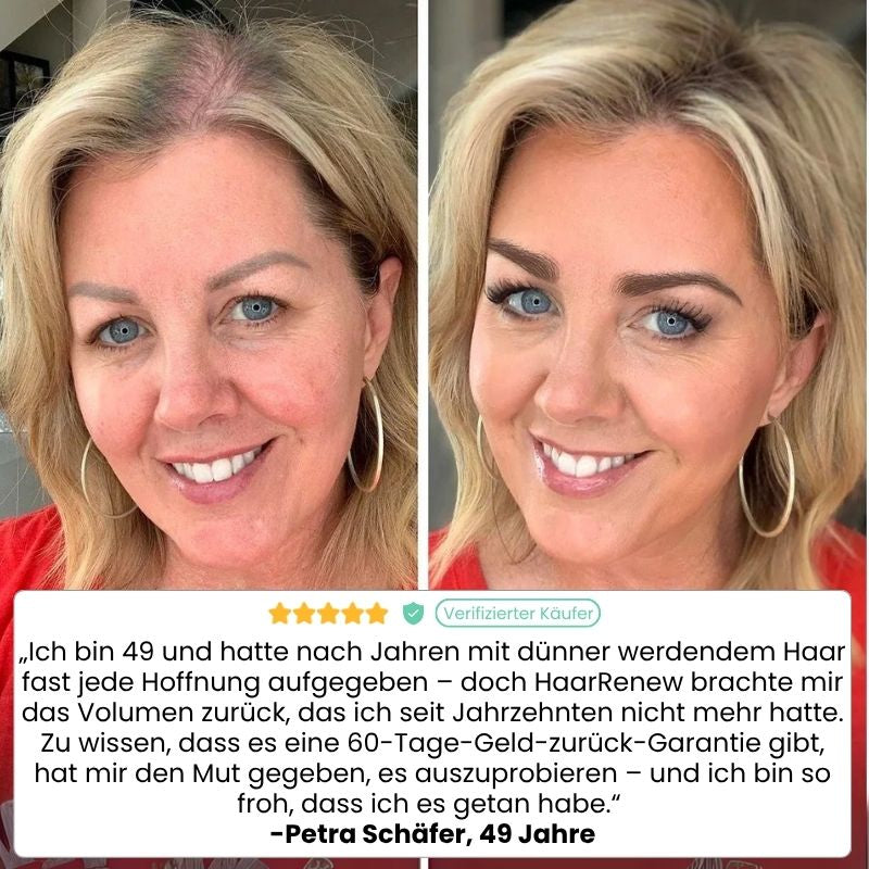 HaarRenew™ | 5 % Minoxidil mit Biotin Haarserum