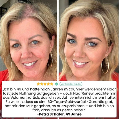 HaarRenew™ | 5 % Minoxidil mit Biotin Haarserum