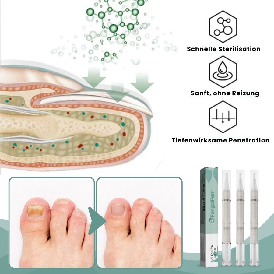 FungalPen™ | Nagelpflege Anti-Pilz-Stift