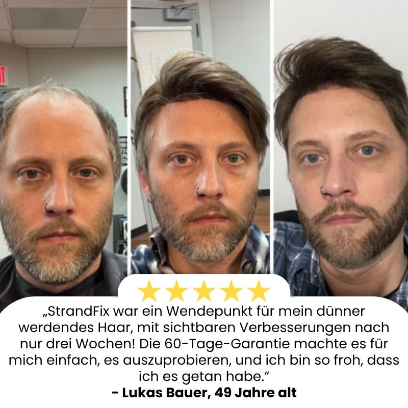 StrandFix™ | Ingwer Haarwuchsserum
