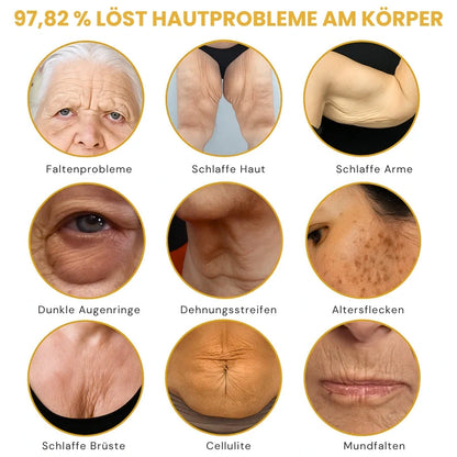 Venomé™ | Botox Faltenstraffende Creme
