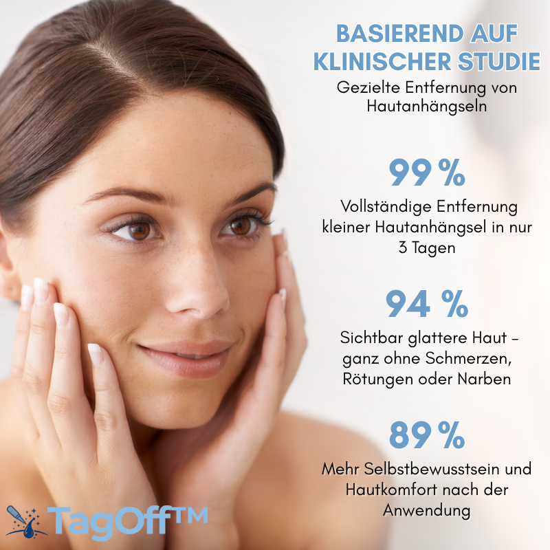 TagOff™ | Komplettset zur Entfernung von Hautanhängseln