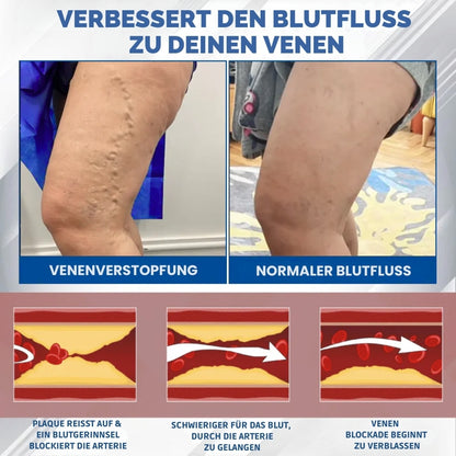 SwelEase™ | Kräutercreme zur Ödempflege