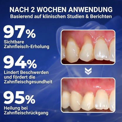 Balancia™ | Bienengift gegen Zahnfleischrückgang