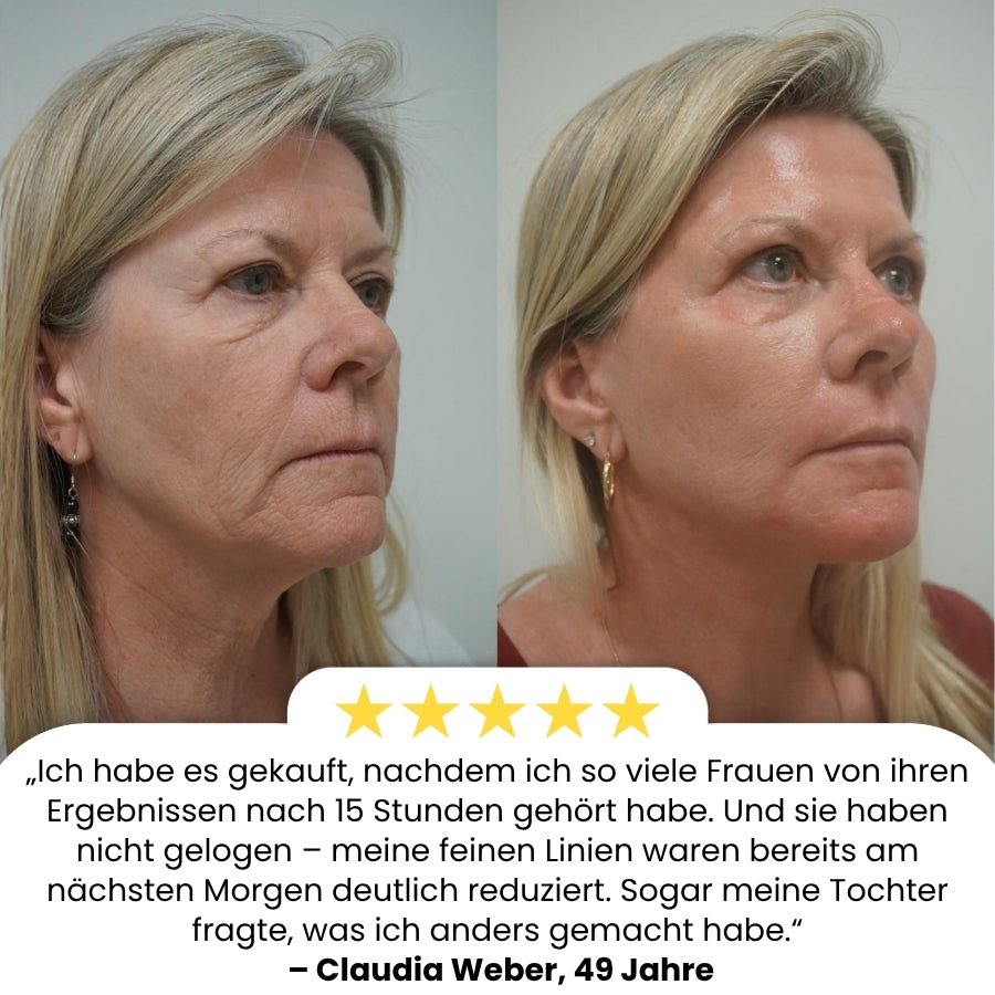DermaPure™ | 15-Stunden-Lifting für das Gesicht
