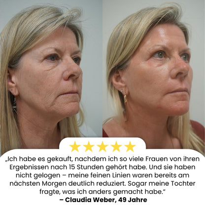 DermaPure™ | 15-Stunden-Lifting für das Gesicht