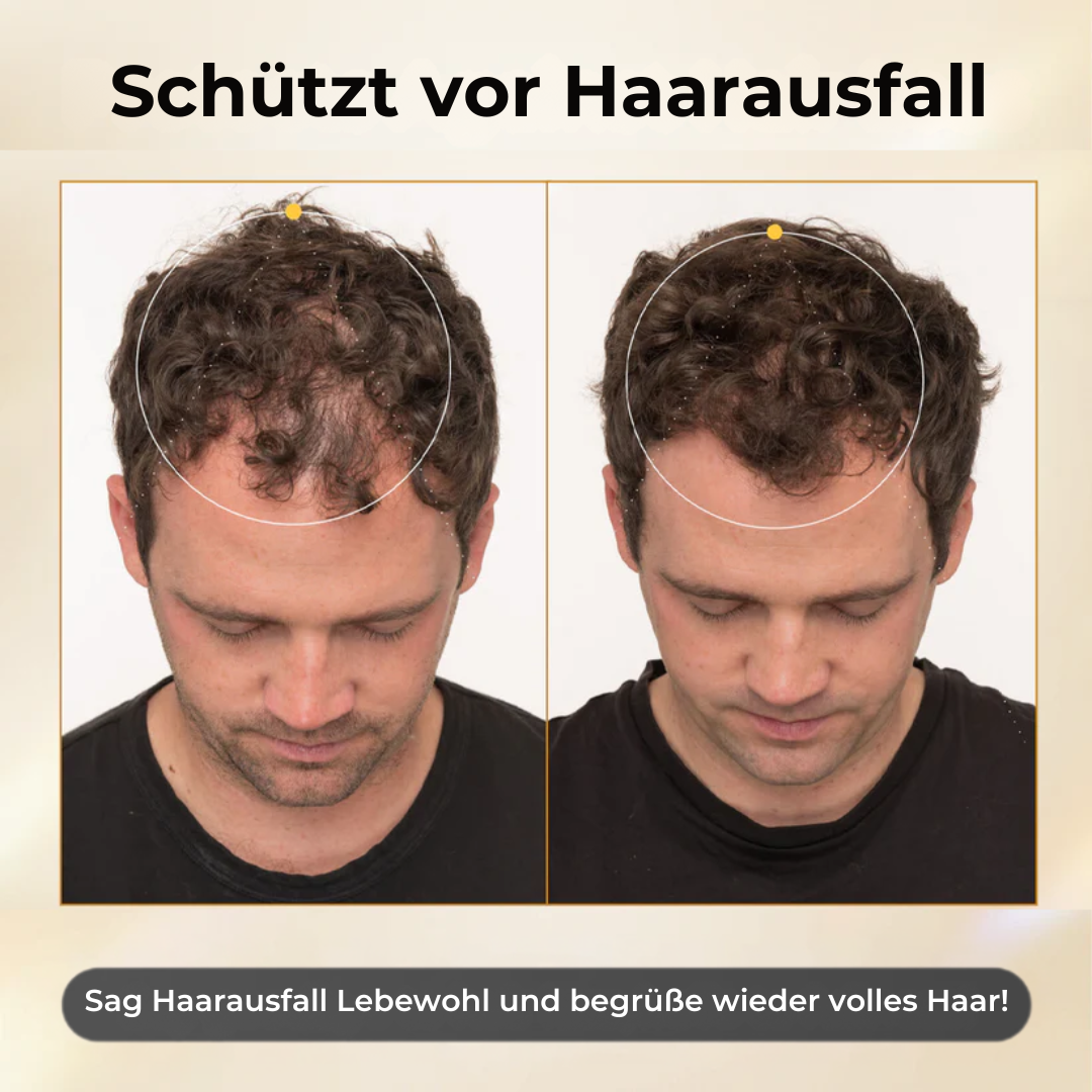 CollagenGrow™ | Haarwuchsspray