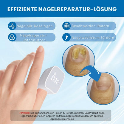 ClearNail Pro™ | Nagelpilz-Lasergerät