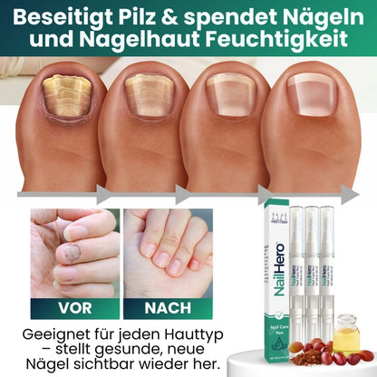 NailHero™ | Nagelpflegestift