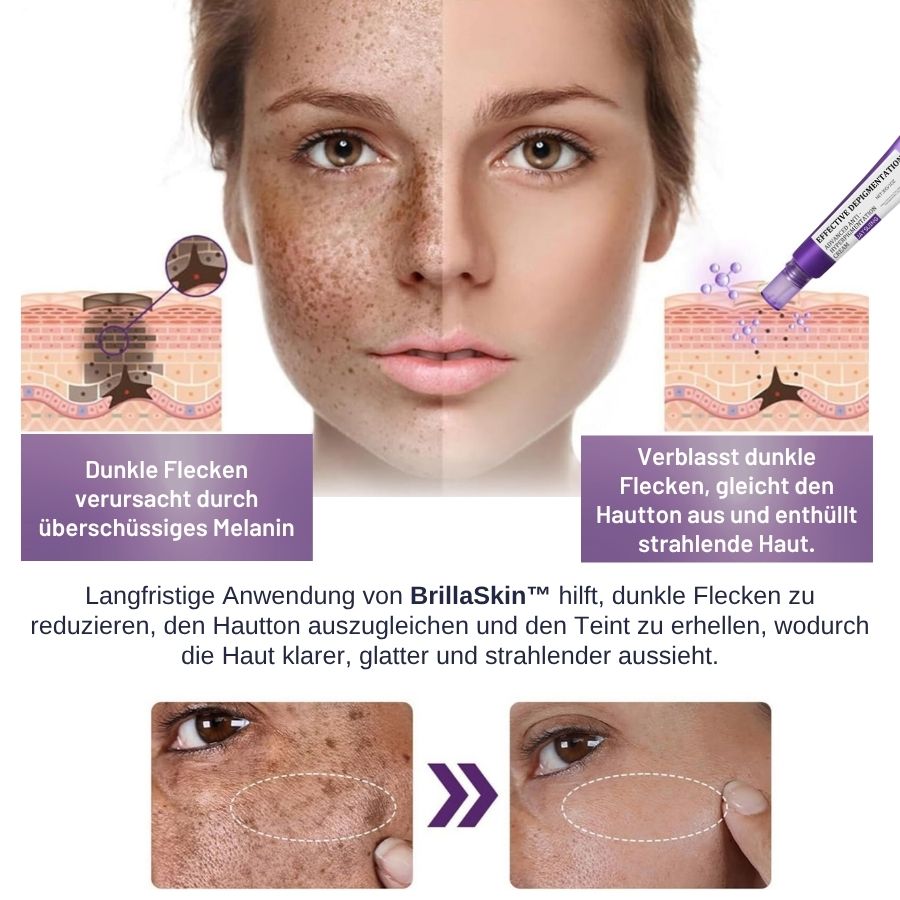 BrillaSkin™ | Fortschrittliche Anti-Hyperpigmentierungscreme