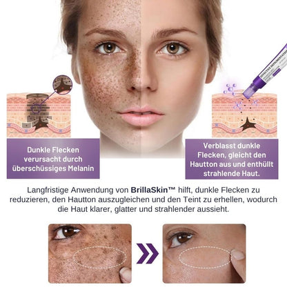BrillaSkin™ | Fortschrittliche Anti-Hyperpigmentierungscreme