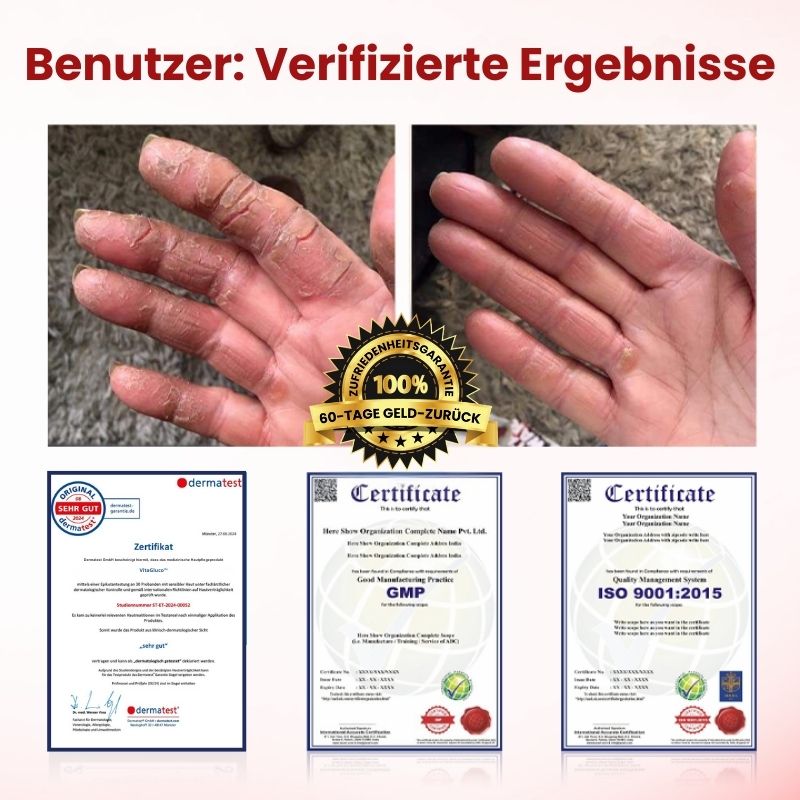 VitaGluco™ | Diabetische Hautreparaturcreme
