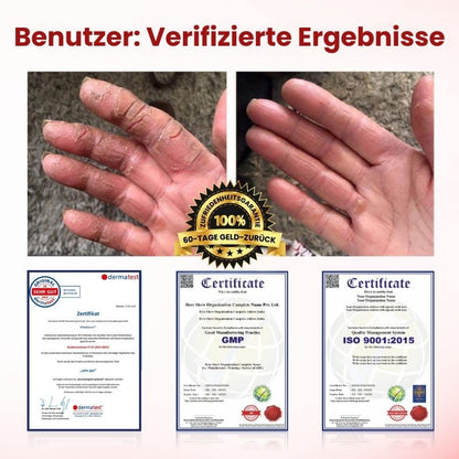 VitaGluco™ | Diabetische Hautreparaturcreme