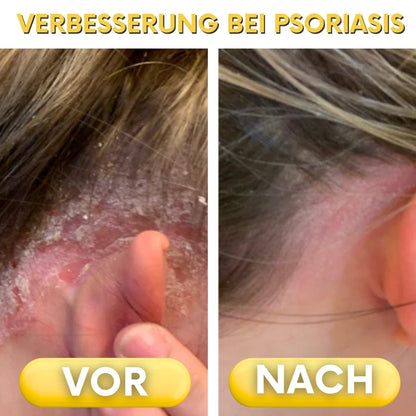 NaturDerm™ | Haut Beruhigende Kräutersalbe
