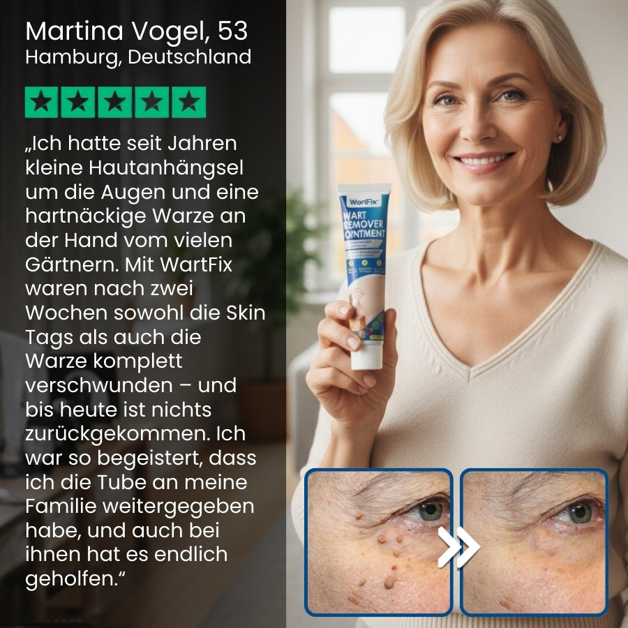 WartFix™ | Warzenentferner-Salbe