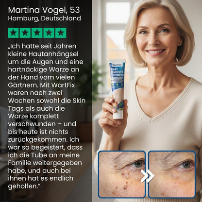 WartFix™ | Warzenentferner-Salbe