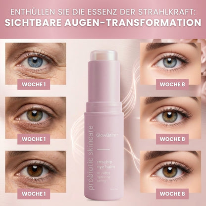 GlowBalm™ | Fortschrittlicher Augenstraffungs-Stick-Balsam
