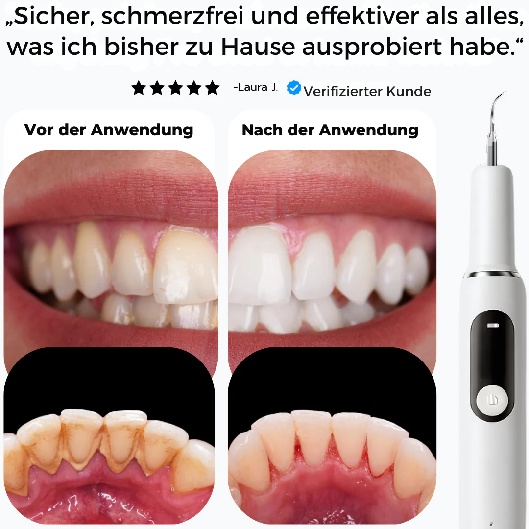 SmiSonic™ | Zahnreiniger