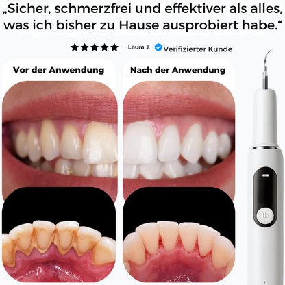 SmiSonic™ | Zahnreiniger