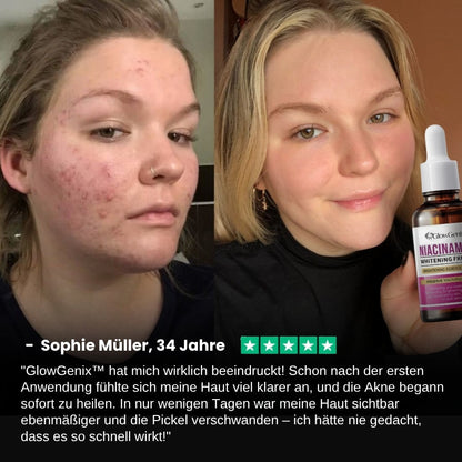 GlowGenix™ | Niacinamid Aufhellendes Sommersprossen Serum